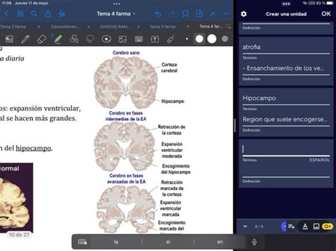 Fichas De Aprendizaje Tema Enfermedades Neurodegenerativas Quizlet