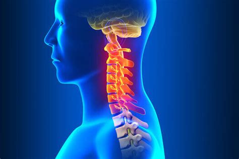 Understanding Cervical Spinal Stenosis