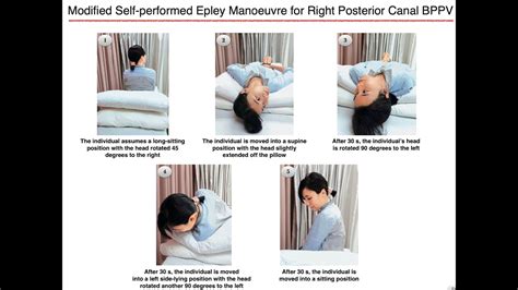 Modified Self Performed Epley Manoeuvre For Right Posterior Canal BPPV