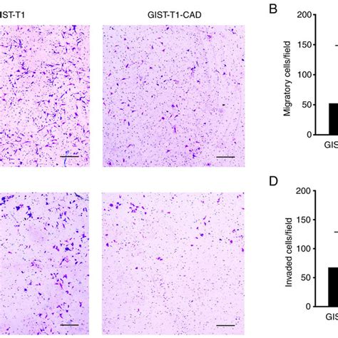 Cadm Expression Suppresses Gist T Cell Migration And Invasion In