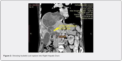 Gastroenterology Open Access Journals Gastroenterology Journals