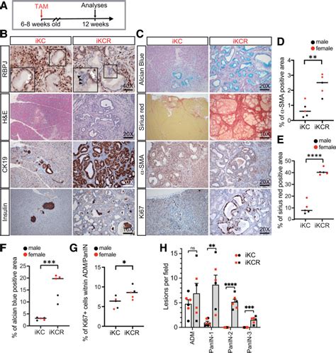 Rbpj Deficiency Sensitizes Pancreatic Acinar Cells To Kras Mediated