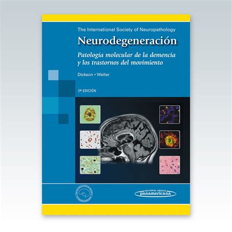 Neurodegeneraci N Patolog A Molecular De La Demencia Y Los Trast Del