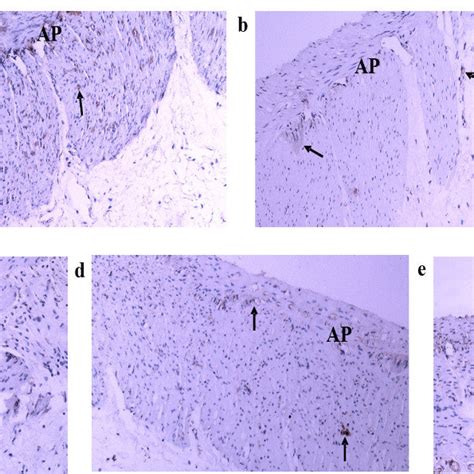 Protein Expression Of NNOS And PGP9 5 In The Gastric Tissue Of Rats In