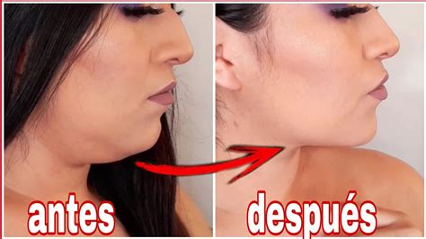 Masaje Para Eliminar La Papada Sin CirugÍa💉💊 Youtube