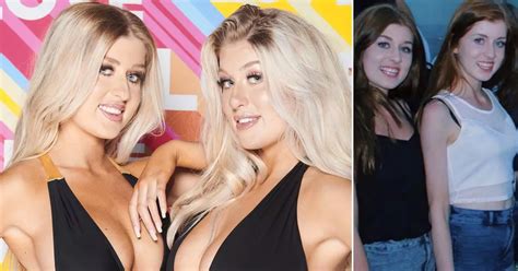 Love Island Twins Jess And Eve Gale Shock Fans As Unrecognisable