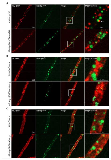 Lipid Droplet Contact Sites With Peroxisomes Mitochondria And Er A