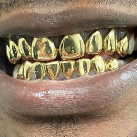 18k Gold Grillz - Gold Teeth Master