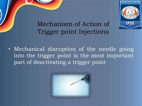 Trigger point injection