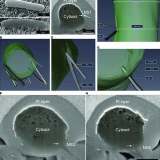 D Fib Sem Reconstruction Of E Coli On To Ns Short Surfaces Automated