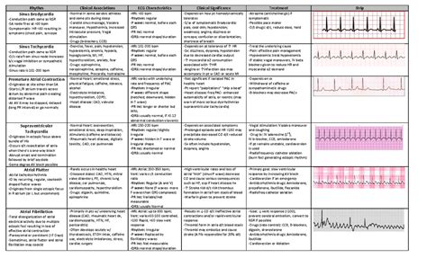 Nr341 Complex Adult Exam Cheat Sheet 2 Rhythm Clinical Associations