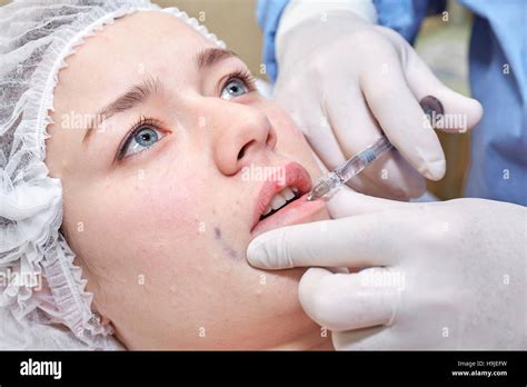 Lip Injection Procedure Lips Filler Young Woman Stock Photo Alamy