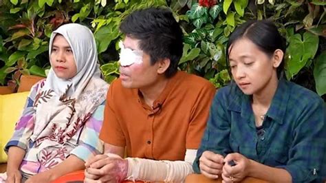 Nasib Uang Donasi Agus Korban Air Keras Usai Diduga Disalahgunakan