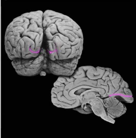 Neuroanatomy Quiz 1 Flashcards Quizlet