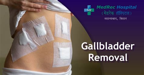 Gallbladder Removal Surgery Everything You Need To Know