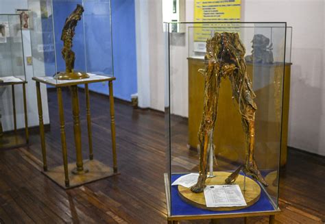 Los Tesoros Macabros De Un Museo Del Ser Humano En Colombia