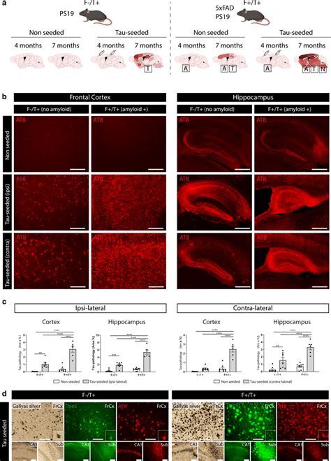 Amyloid Pathology Aggravates Tau Seeded Tau Pathology And Propagation