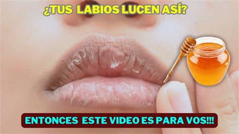 HIDRATAR LOS LABIOS RESECOS Y AGRIETADOS El Remedio 1 YouTube