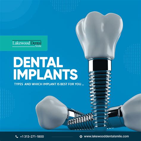 Types of Dental Implants | Which Implant Is Best for You...