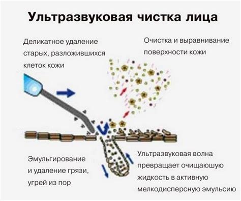 Удаление комедонов кожи, черных точек, угрей на лице