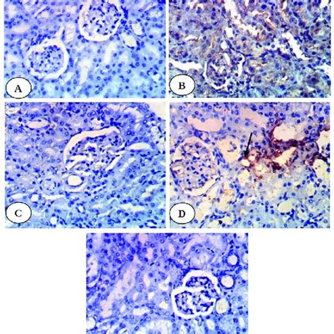 Photomicrographs Of Immunohistochemical Staining Of Tnf In Kidney