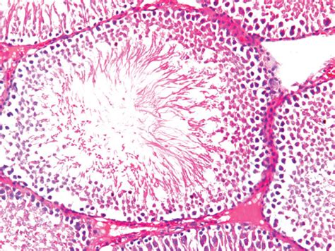 Representative Photomicrograph Of Testis Sections A D From The