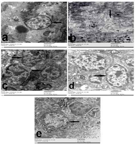 Effects Of Combining AG With CAR On Cerebellum Of TAA Treated Rats As