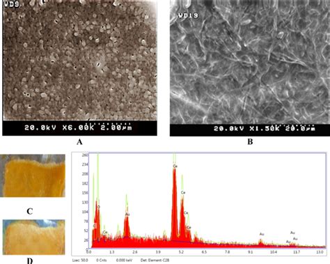 Study Of Nerve Cell Regeneration On Nanofibers Containing Cerium Oxide