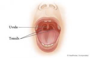 Swollen Uvula - Symptoms, Causes, Treatment and Remedies