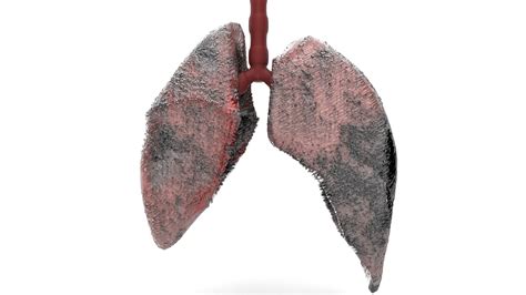 3d Healthy Smoker Lungs Model Turbosquid 1685184