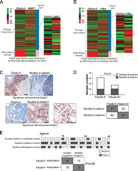 Figure From Fibulin Inhibits Wnt Catenin Signaling In Lung Cancer