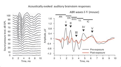 Acoustically Evoked Auditory Brainstem Responses Abr From Mice The Download Scientific