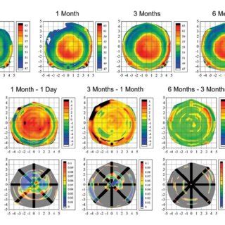 Top Row Topographic Maps Of The Mean Epithelial Thickness Profi Le At