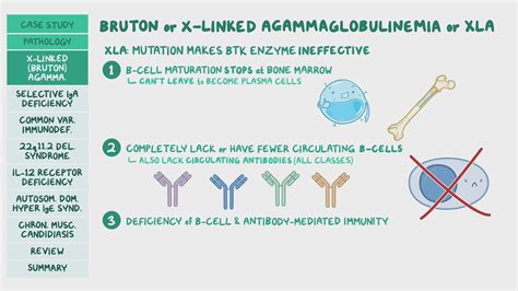 Immunodeficiencies T Cell And B Cell Disorders Pathology Review Osmosis