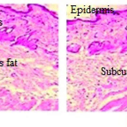 Histological Findings Of Skin Biopsies From Wistar Rats Control A