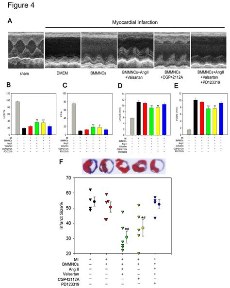 Transplantation Of AT2R Stimulated BMMNCs Improved Global Heart