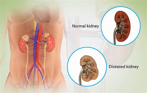 Health Condition Symptoms Causes Treatment And More