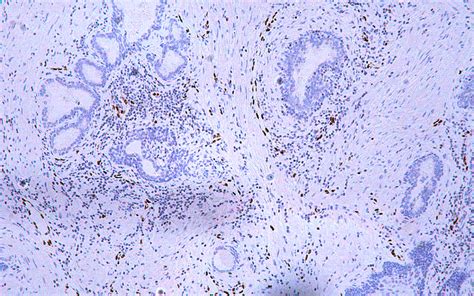 Erg Antibody Rabbit Monoclonal Antibody Mab Ihc Buy Now