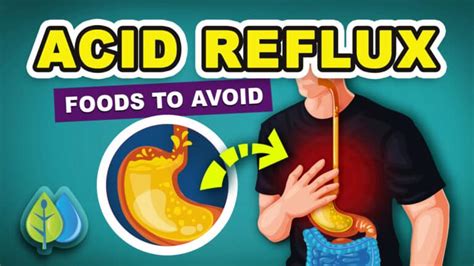 4 Simple Home Remedies To Help Manage Acid Reflux