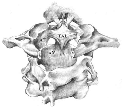 Anatomy of the atlantoaxial complex. The transverse atlantal ligament... | Download Scientific ...