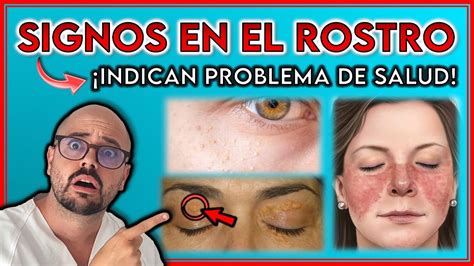 Estos SIGNOS En Tu ROSTRO Te Alertan De Un PROBLEMA DE SALUD No