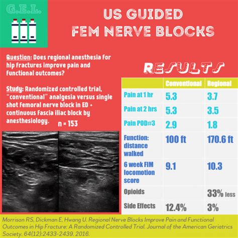 Femoral Nerve Block Ultrasound Hot Sex Picture