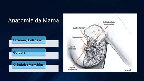 Carcinoma Ductal In Situ Apresentação Ppt