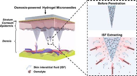 Schematic Of Osmosis Powered Hydrogel Microneedles For Skin Download Scientific Diagram