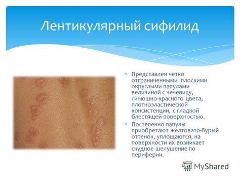 Презентация на тему: "Вторичный и третичный сифилис ". Скачать ...