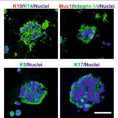 Organoid Cultures Derived From Luminal And Myoepithelial Cells Give