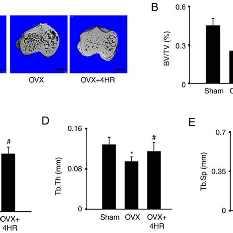 Hr Treatment Reverses Ovariectomy Induced Bone Loss In Vivo A