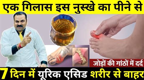 Uric Acid Uric Acid Treatment In Hindi Uric Acid Kam Karne Ke Upay Uric Acid Ka Ilaj