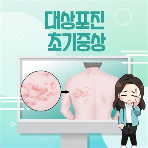 대상포진에좋은음식 과 초기증상 및 원인 전염성 예방접종 치료 네이버 블로그