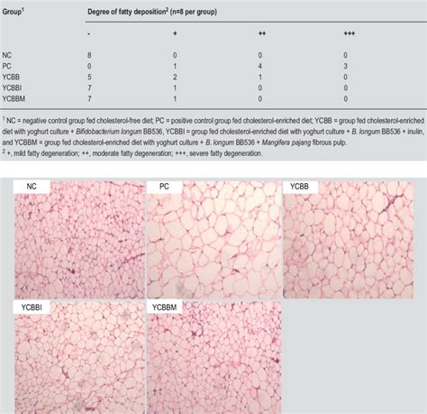 Adipocytes In Adipose Tissue Sections In Rats Fed Cholesterol Free And